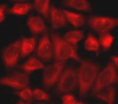Anti-Triosephosphate isomerase