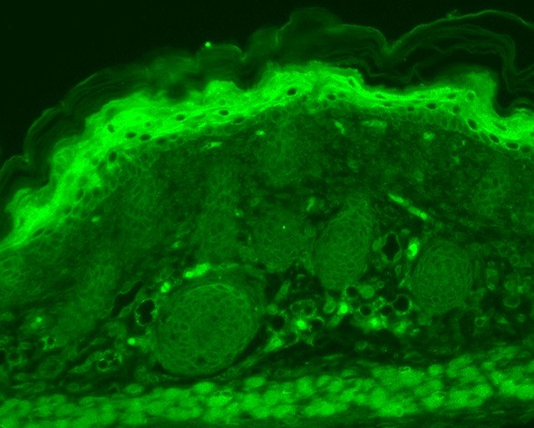 Anti-TRPV3, clone S15-4