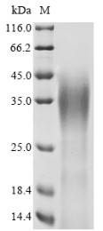 Ataxin-7 (ATXN7), partial, human, recombinant