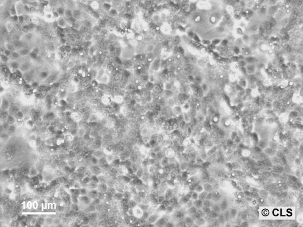 Capan-2 Cells