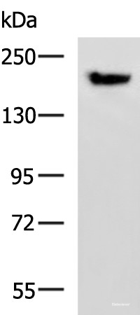 Anti-PDS5B