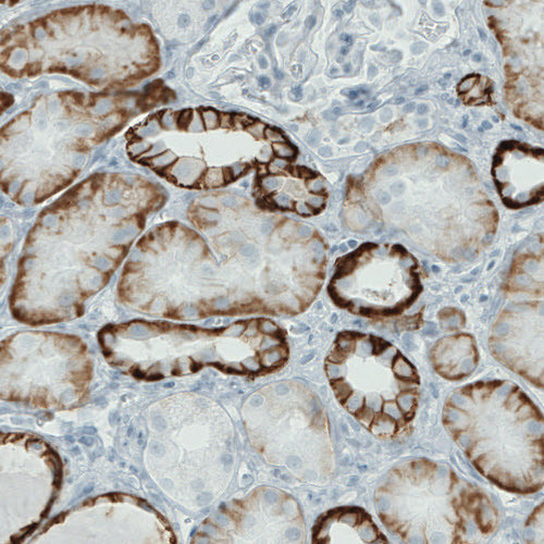 Anti-CA12, clone CL0278