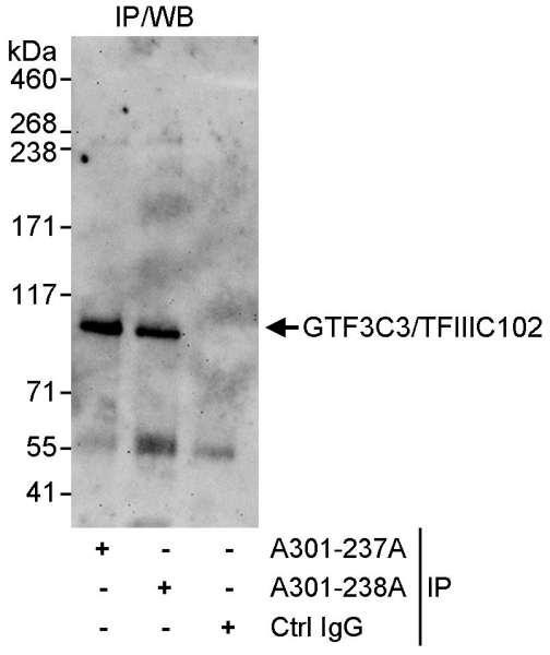 Anti-GTF3C3/TFIIIC102