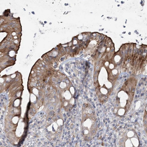 Anti-SCN11A
