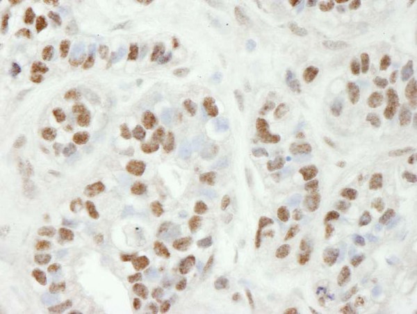 Anti-ZC3H11A (IHC)