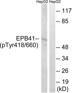 Anti-Phospho-EPB41 (Tyr660/418)