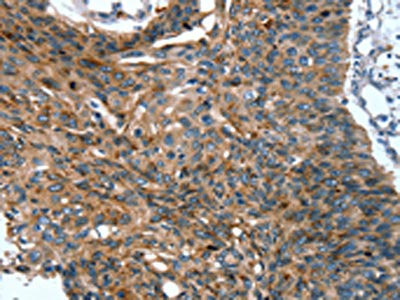 Anti-SCPEP1