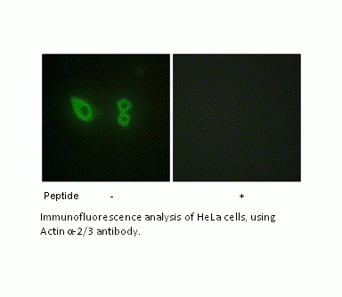 Anti-Actinin alpha-2/3