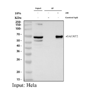 Anti-GALNT2 / Polypeptide N-acetylgalactosaminyltransferase 2