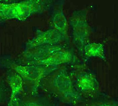 Anti-DMD / Dystrophin