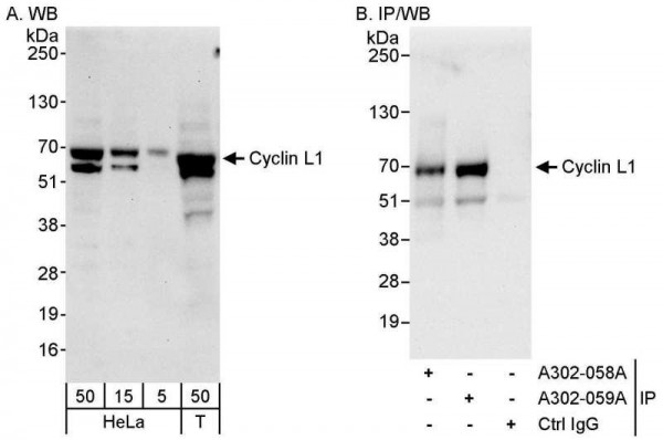 Anti-Cyclin L1