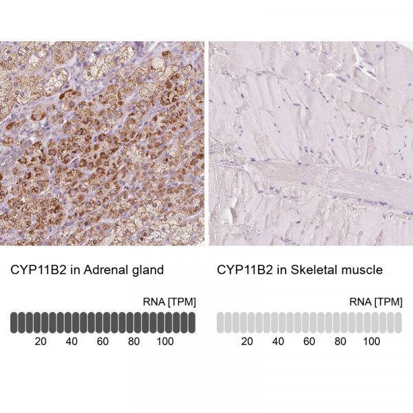 Anti-CYP11B2