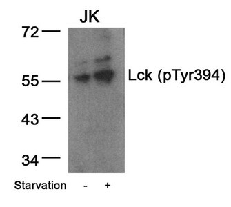 Anti-Phospho-LCK (Tyr394)