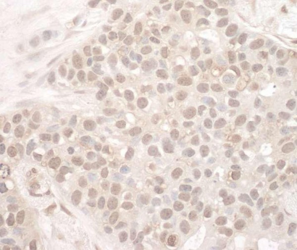Anti-EYA2 (IHC)