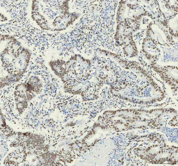 Anti-HNRNPM / heterogeneous nuclear ribonucleoprotein M, clone 29H77