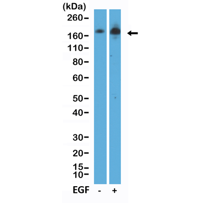 Anti-phospho-EGFR (Tyr1068) (human), Rabbit Monoclonal (RM443)