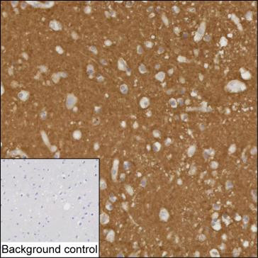 Anti-BASP1