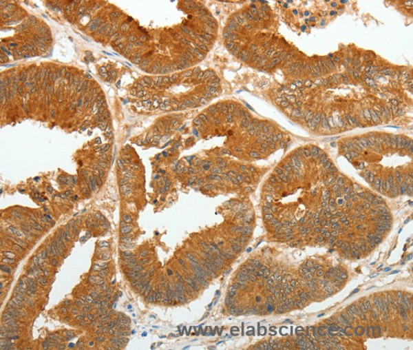 Anti-ASCL1