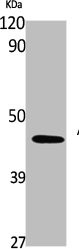 Anti-SERPINA1