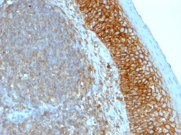 Anti-CD44 / HCAM (Cancer Stem Cell Marker), clone SPM544