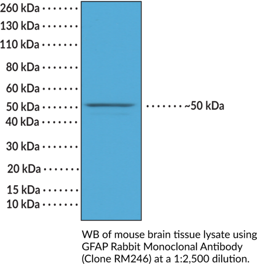 Anti-GFAP Rabbit (Clone RM246)