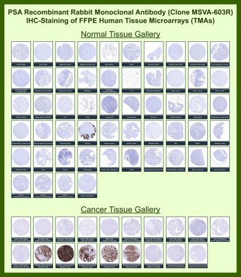 Anti-PSA / Prostate Specific Antigen / KLK3, clone MSVA-603R