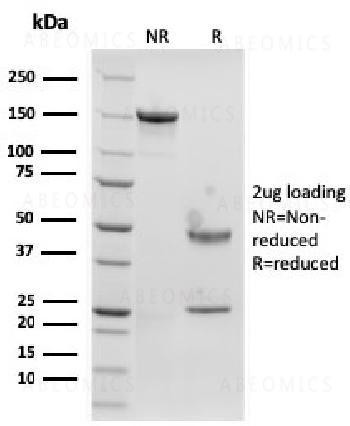 Anti-Langerin / CD207 (Marker of Langerhans Cells) Monoclonal Antibody (Clone: rLGRN/1821)