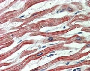 Anti-EPM2AIP1