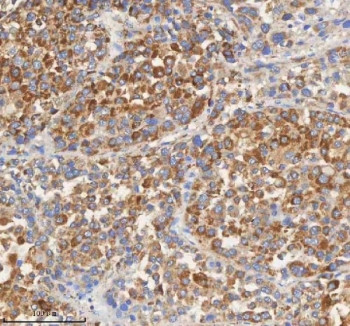 Anti-PCCA / Propionyl-CoA carboxylase alpha