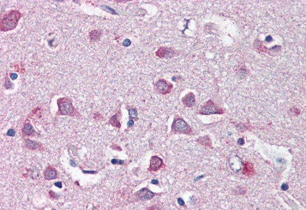 Anti-Neurofibromin 2 (Zebrafish), Internal