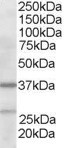 Anti-ARP2/3 subunit 1B, N-terminal