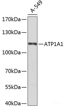 Anti-Na+/K+-ATPase alpha1