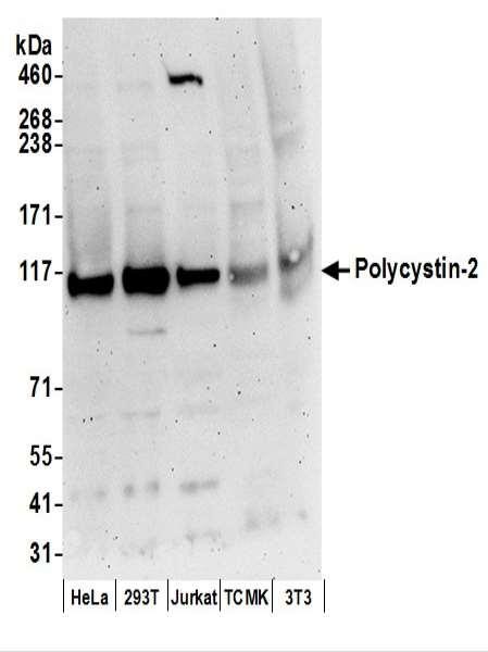 Anti-Polycystin-2