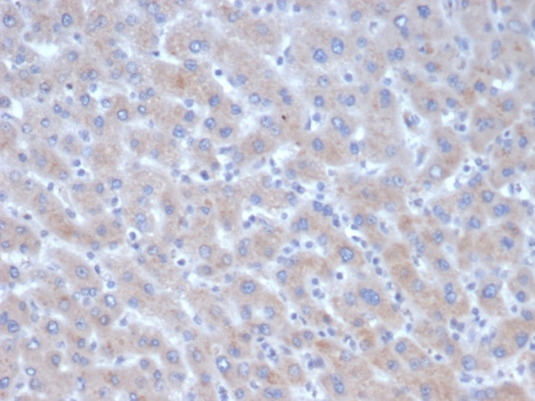 Anti-Alpha-1-Antichymotrypsin (SERPINA3) (Histiocytoma Marker), clone SERPINA3/4185