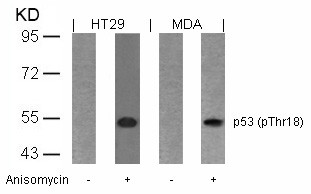 Anti-phospho-p53 (Thr18)