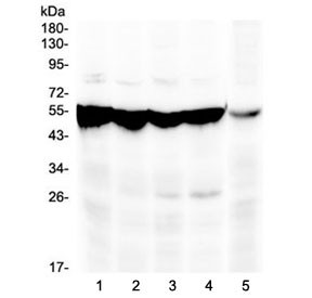 Anti-PAH / Phenylalanine hydroxylase