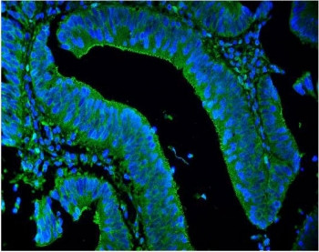 Anti-LPP / Lipoma preferred partner
