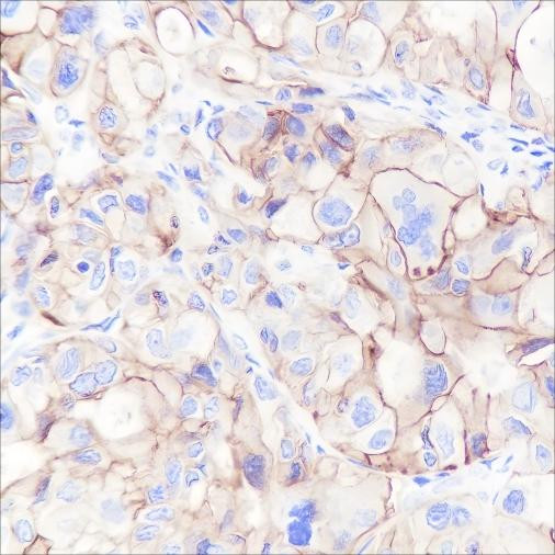 Anti-Recombinant CD47, clone A175