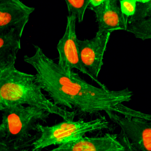 Anti-Monomethyl-Histone H4 (Arg3), Rabbit Monoclonal (RM195)