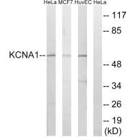 Anti-KCNA1