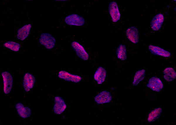 Anti-PPIL2 Monoclonal Recombinant Antibody