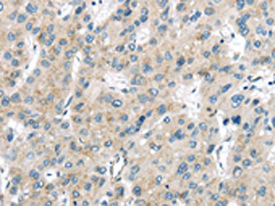 Anti-VPS26A