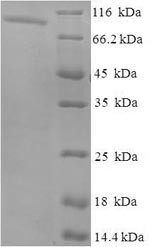 Inactive N-acetylated-alpha-linked acidic dipeptidase-like protein 2 (NAALADL2), partial, human, rec