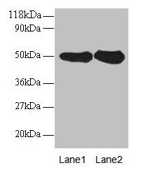 Anti-RPN1