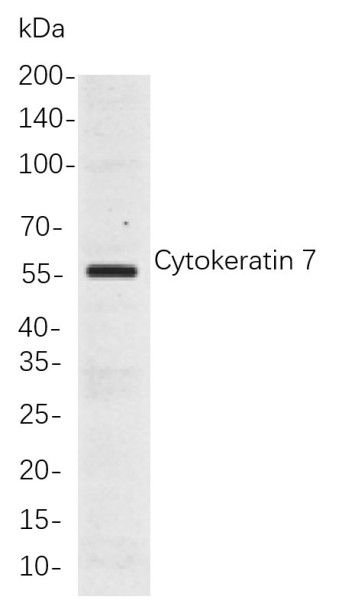 Anti-Recombinant Cytokeratin 7, clone 4F5
