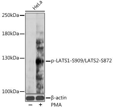 Anti-phospho-LATS1 (Ser909) /LATS2 (Ser872)