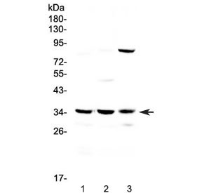 Anti-Bikunin / AMBP