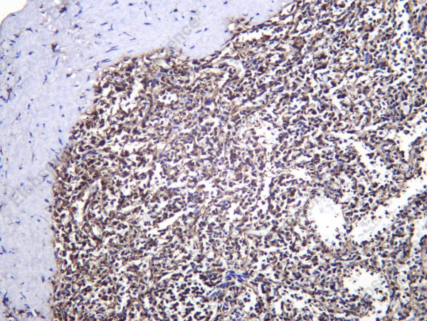 Anti-Recombinant PSMB9, clone C112605