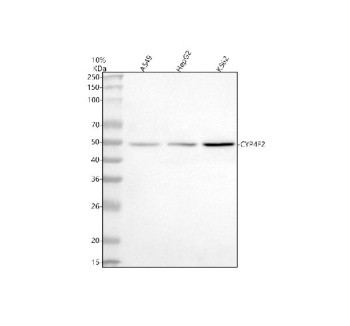 Anti-CYP4F2 / Cytochrome P450 4F2