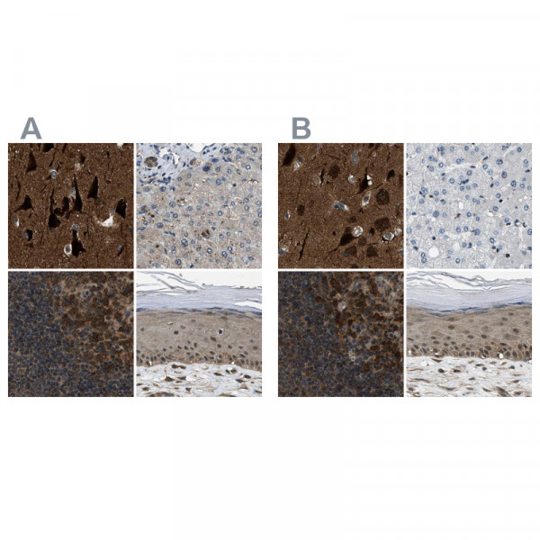Anti-NUDCD3